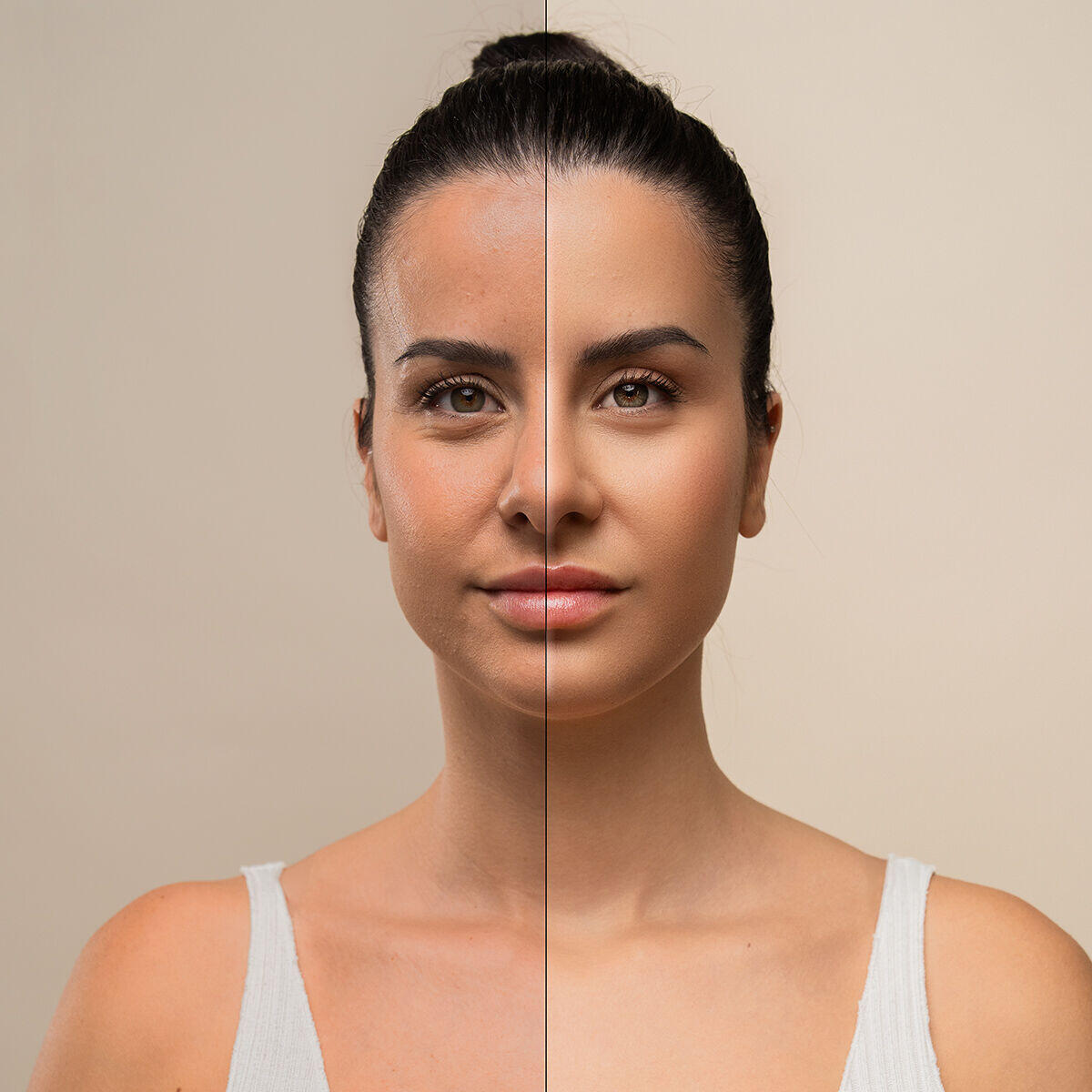 tonificación facial