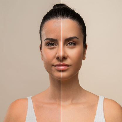 tonificación facial