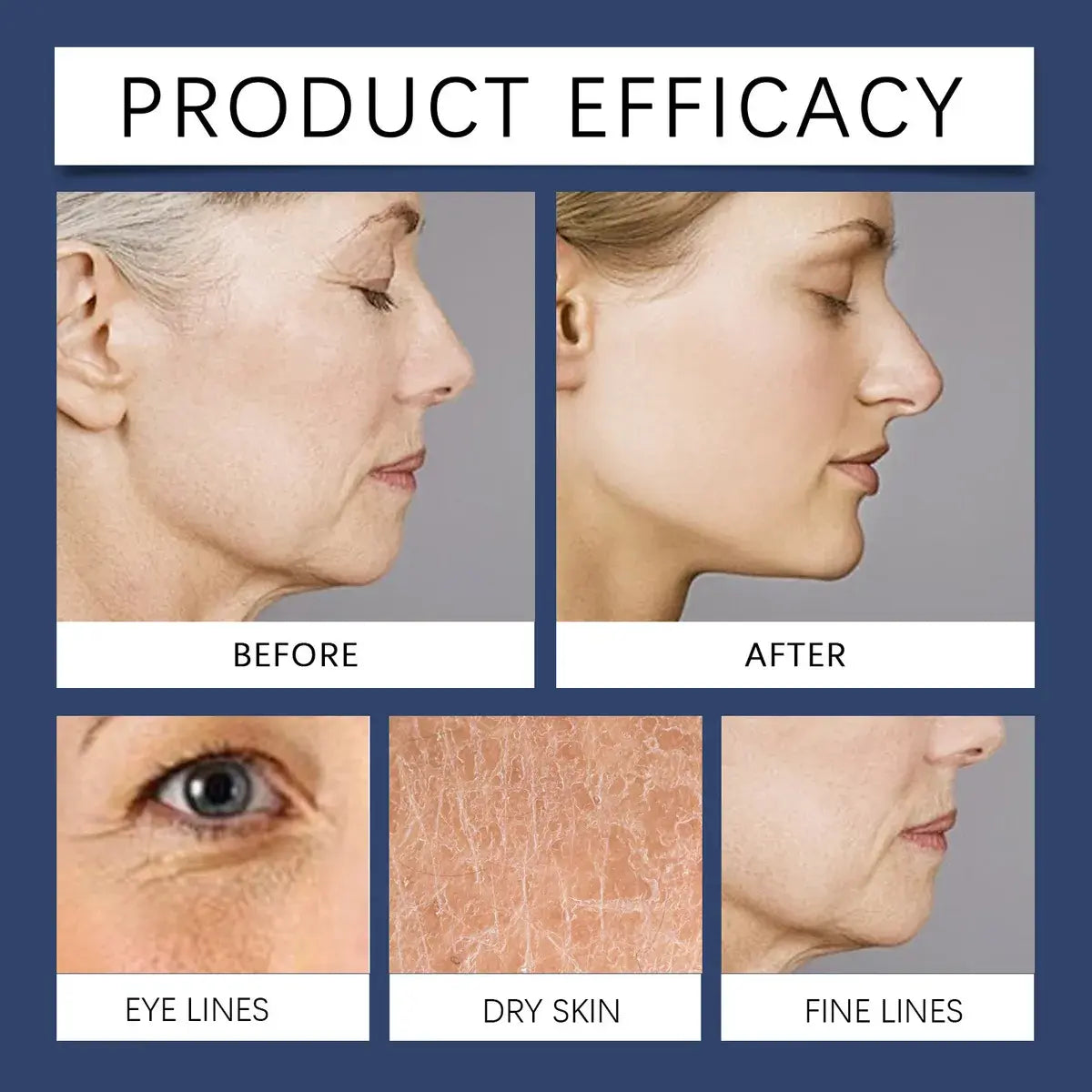 rejuvenecimiento-piel